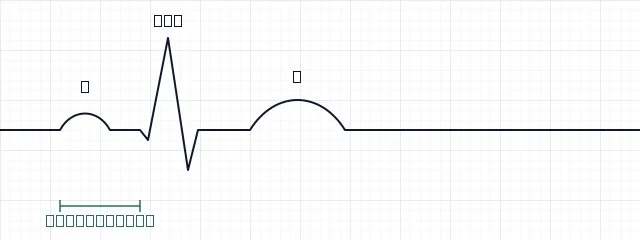 Schematisch ECG van één hartslag op ruitjespapier. Een kleine golf (P), een hoge, smalle uitslag (QRS) en een brede, lage golf (T). Het PR-interval loopt van het begin van de P-golf tot het begin van het QRS-complex.